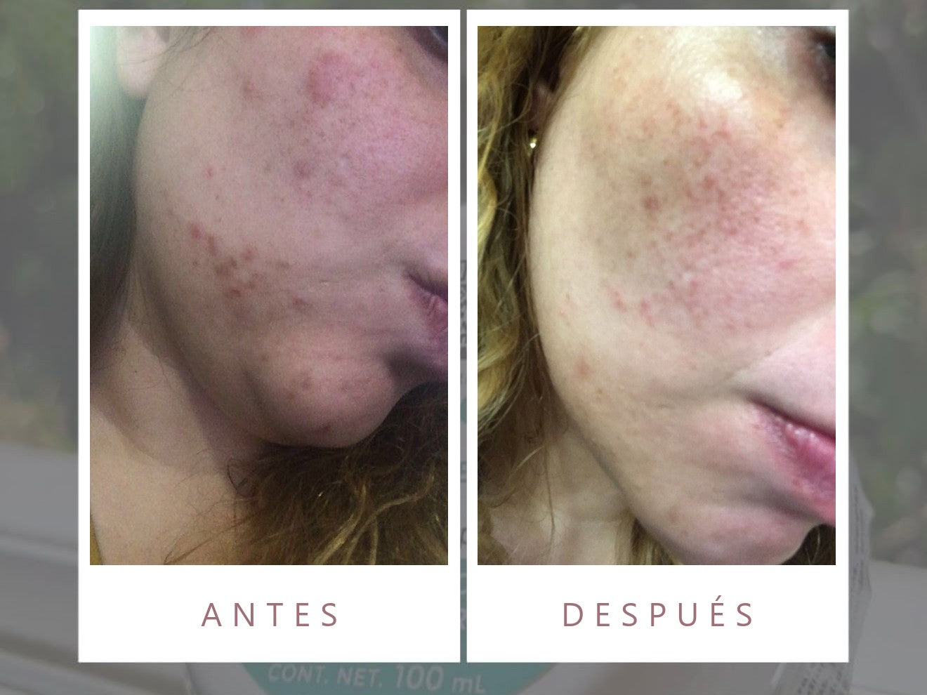 Antes y después con productos LUMINE