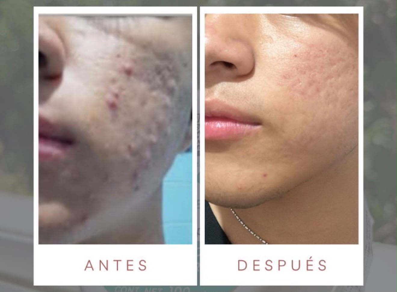Antes y después con productos LUMINE