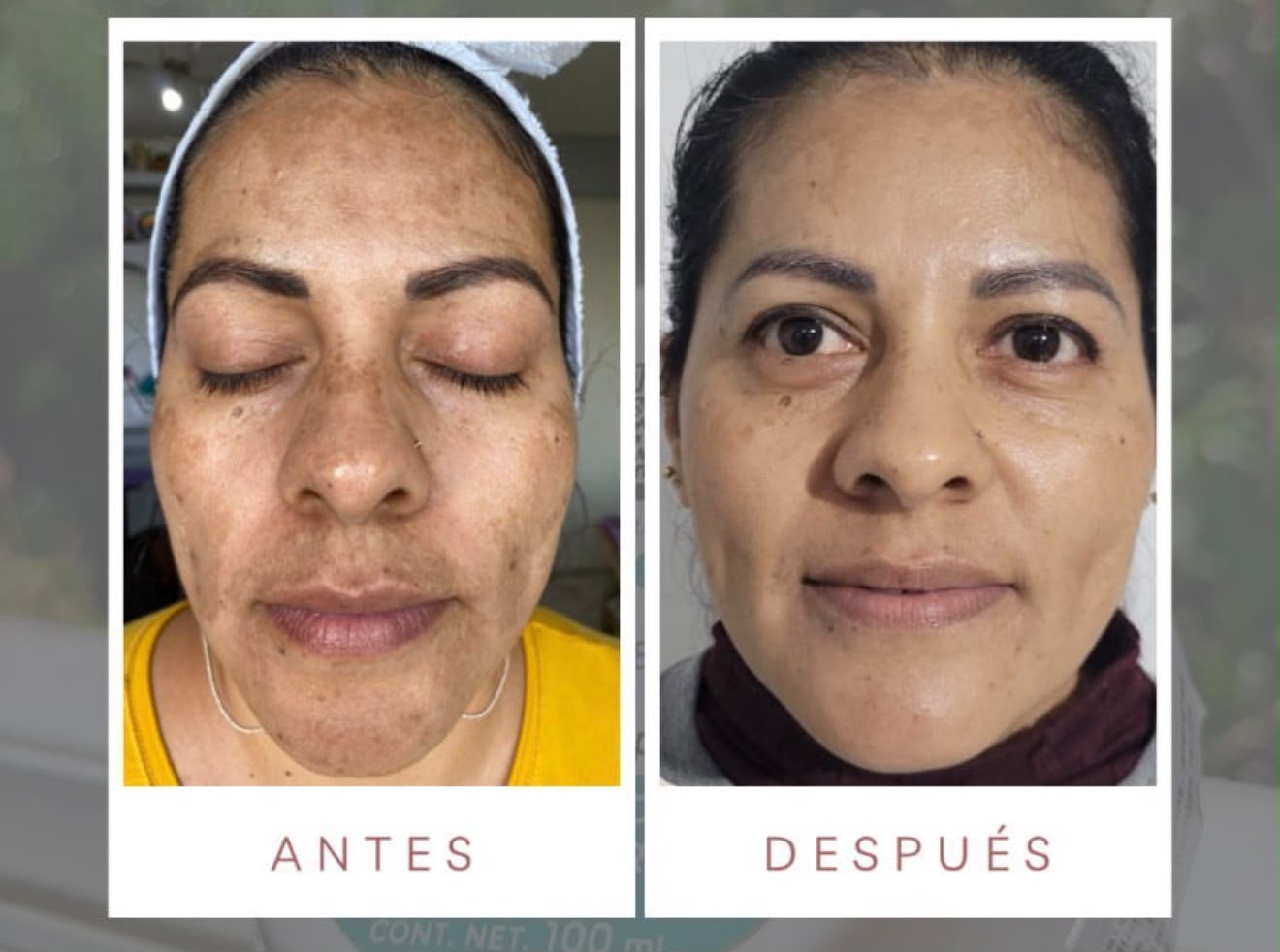 Antes y después con productos LUMINE
