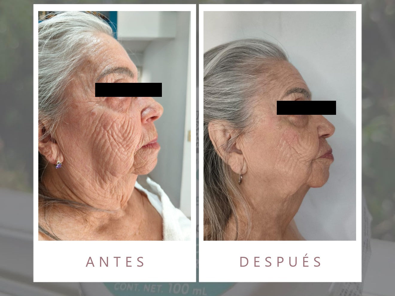 Antes y después con productos LUMINE